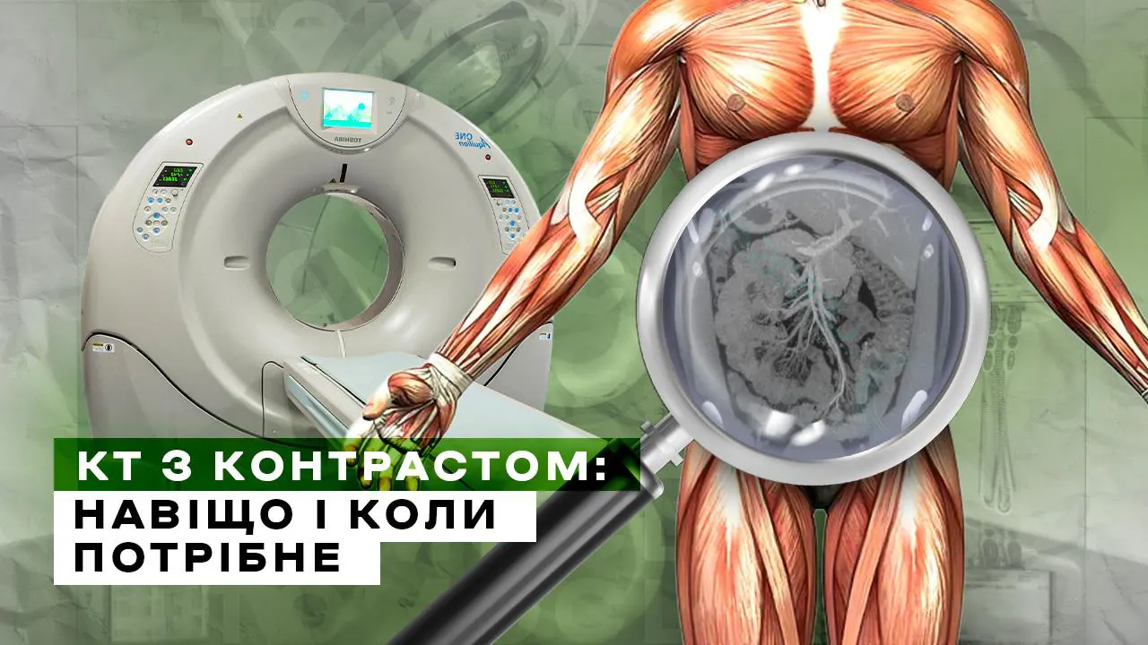КТ з контрастом: коли це потрібно і що це дає