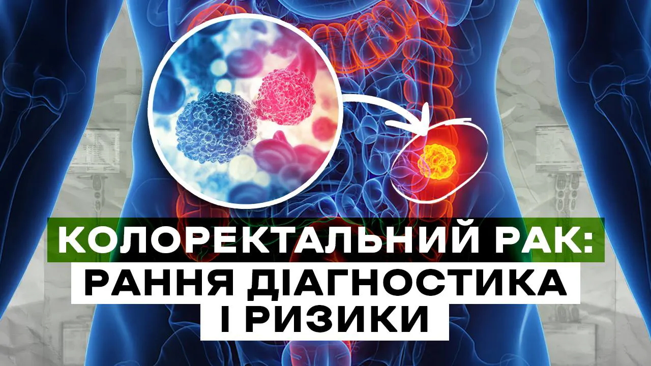 Колоректальний рак: рання діагностика та кому потрібен скринінг